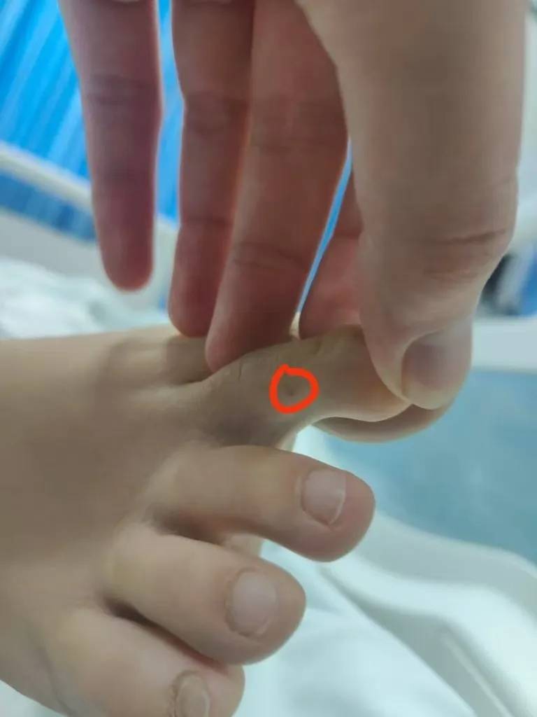 女子疑被蛇咬身亡事件进展:家属正在酒店收拾逝者遗物,称暂无处置结果